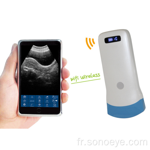 Scanner à ultrasons transvex portable
